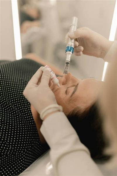 Tratamiento de microneedling facial en clínica estética