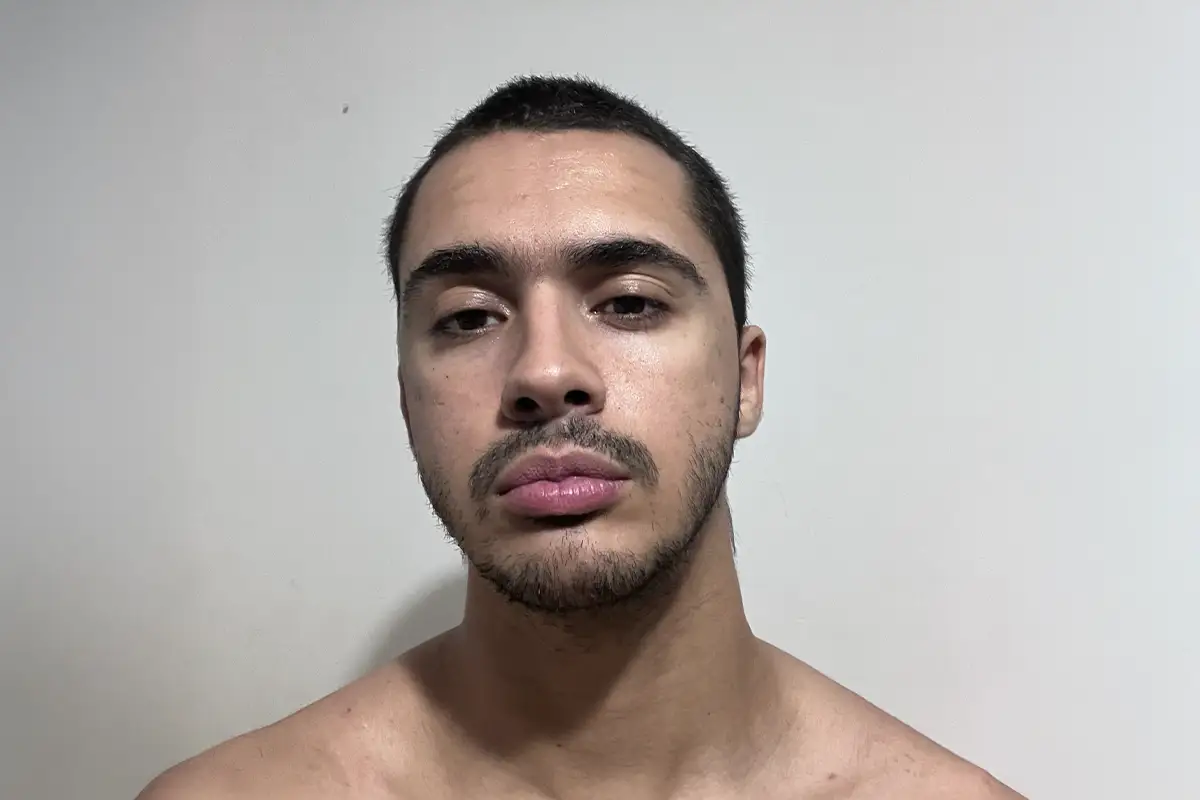 Retrato Skinsfromtheinsideofmymouth